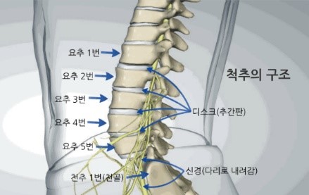 척추협착증과 허리디스크의 차이점