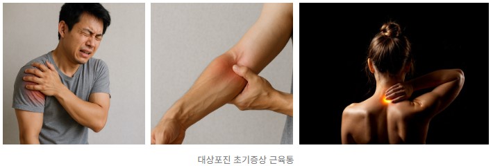 면역력 저하 대상포진 증상